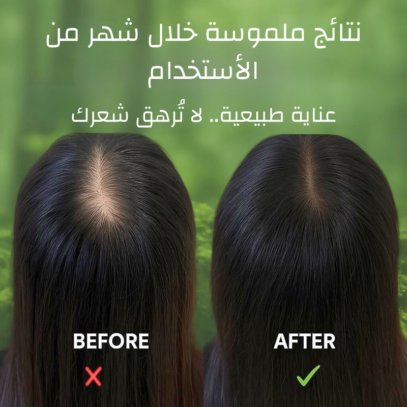 صابونة الأعشاب الطبيعية – تُحيي جمال شعركِ من الجذور إلى الأطراف